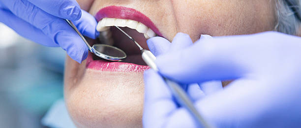 Dentist for Dental Trauma in CA